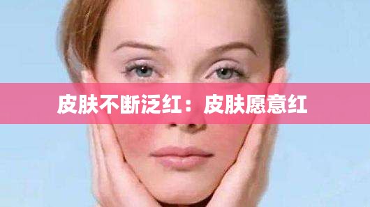 皮肤不断泛红：皮肤愿意红 