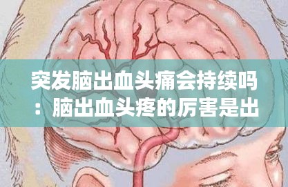 突发脑出血头痛会持续吗：脑出血头疼的厉害是出血加重了吗? 