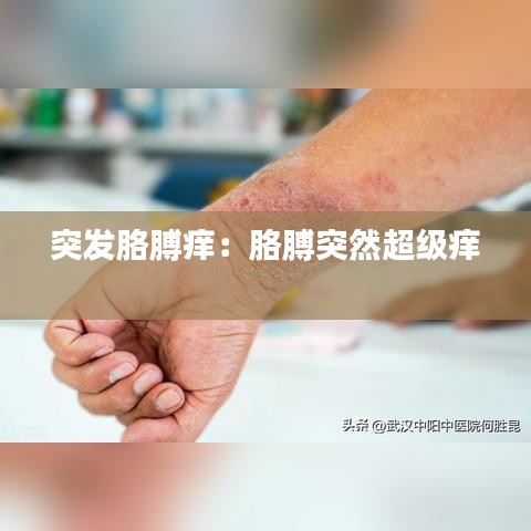 突发胳膊痒：胳膊突然超级痒 
