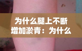为什么腿上不断增加淤青：为什么腿上一直出现淤青 