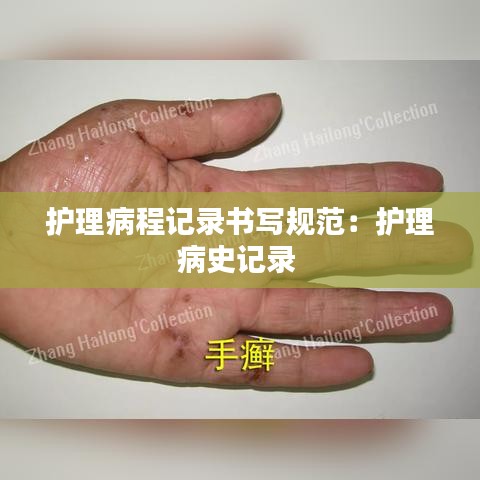 护理病程记录书写规范：护理病史记录 